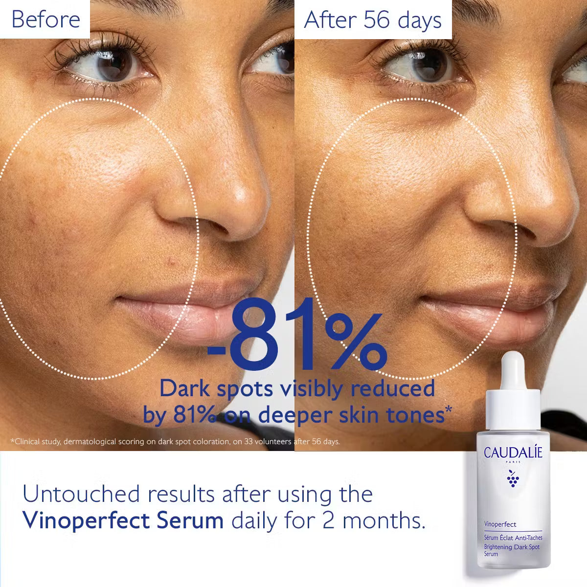 French - Vinoperfect Dark-spot correcting summer Duo